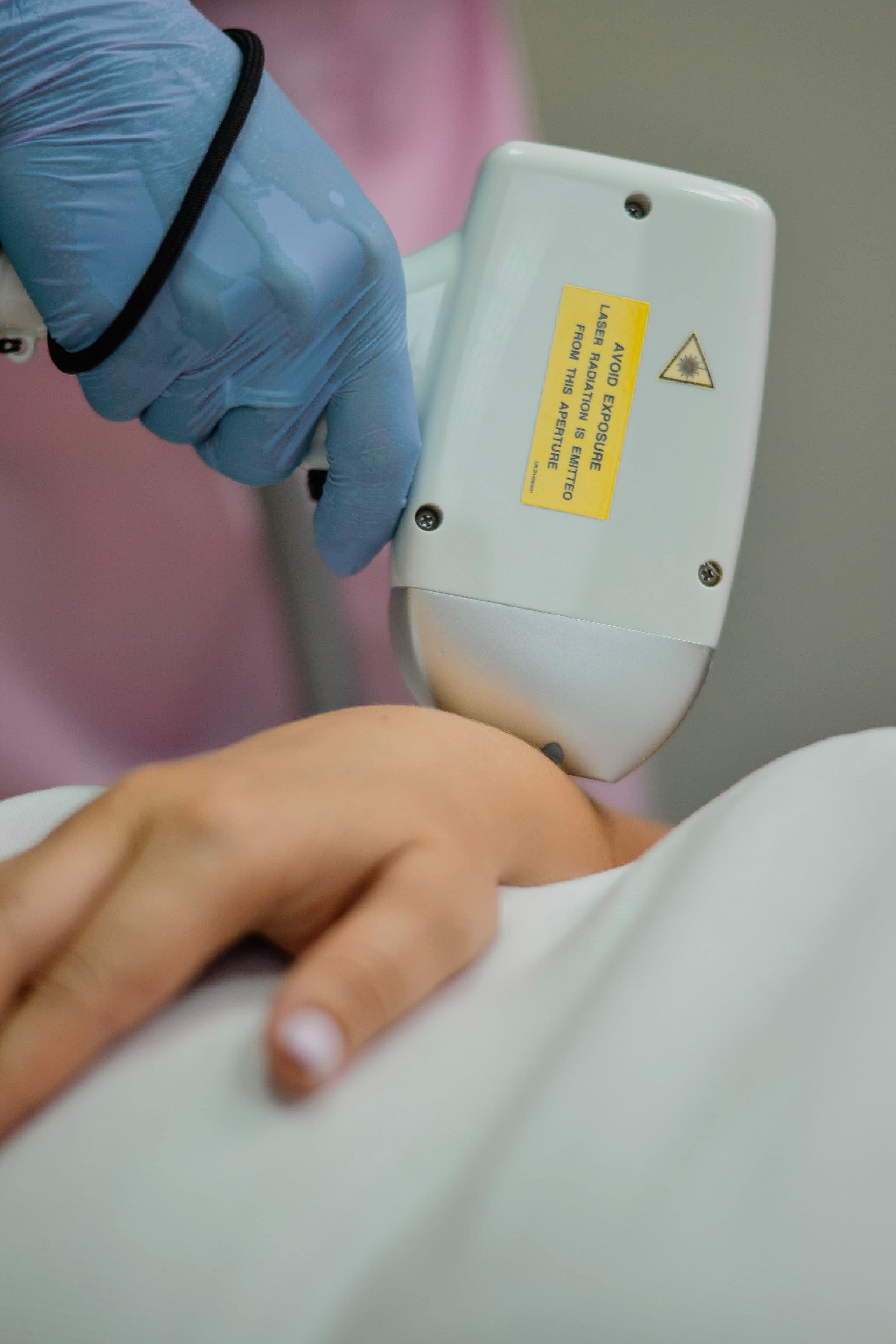 лазерная эпиляции кисти руки